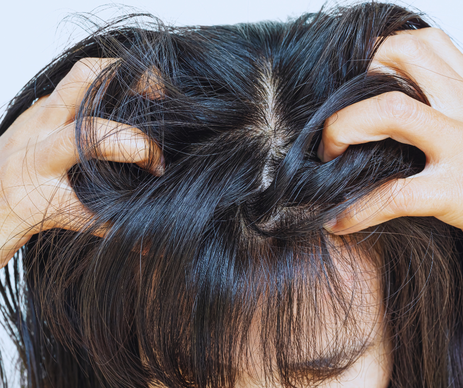 Podrażniona skóra głowy